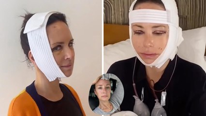 Catt Sadler details facelift at age 48: I give ‘zero f—ks what people think’.
