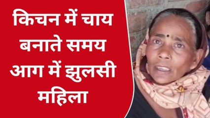 उन्नाव: चाय बनाते समय महिला के दुपट्टे में लगी आग से मचा हड़कंप, इलाज के दौरान हुई मौत