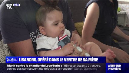 Lisandro sauvé d'un anévrisme grâce à une opération réalisée dans le ventre de sa mère