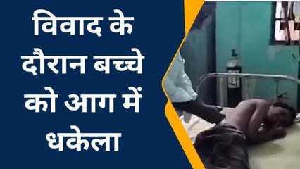 मुज़फ्फरपुर: सकरा में घेरा तोड़ने के विवाद के दौरान बच्चे को आग में धकेला, हाथ जला