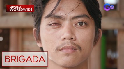 Lalaki, nabulag ang isang mata nang matalsikan ito ng bagoong! | Brigada