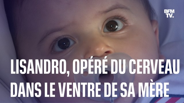 Lisandro a été opéré du cerveau dans le ventre de sa mère, une première mondiale