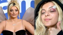 Bebe Rexha Hit In Face After Fan Throws Phone On Stage