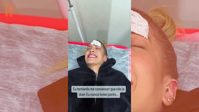 Lore Improta leva pontos no rosto depois de acidente doméstico