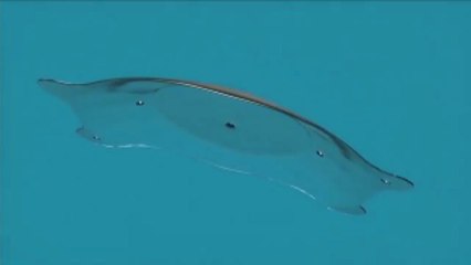 Miopia e difetti visivi: le lenti Icl valida alternativa al laser