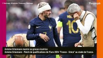 PHOTO Antoine Griezmann dévoile son impressionnante blessure, sa femme Erika furieuse !