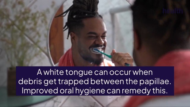 What Causes a White Tongue? Here’s What Dentists Want You To Know