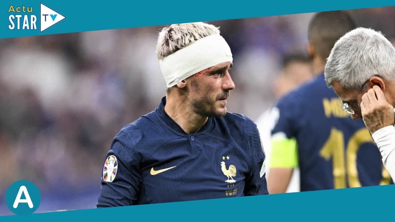 PHOTO Antoine Griezmann dévoile son impressionnante blessure, sa femme Erika furieuse !