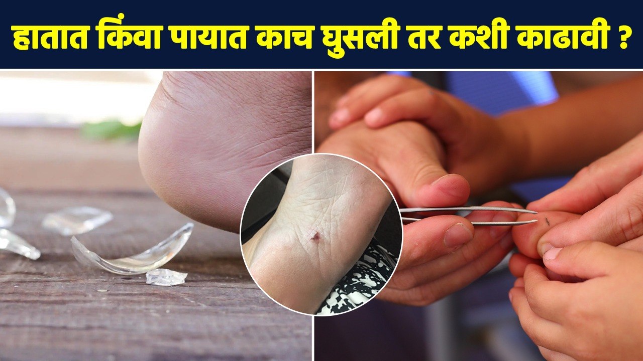 काच लागली तर घरीच ‘हे’ उपाय करा | How to Remove...