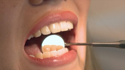 Your Dentist Wants You to Eat These Foods Differently