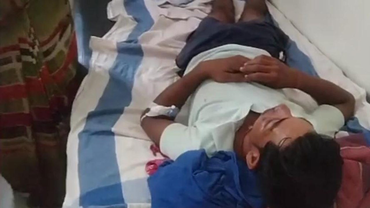 सीधी: तेज रफ्तार बाइक का बिगड़ा संतुलन, युवक हुआ गंभीर घायल