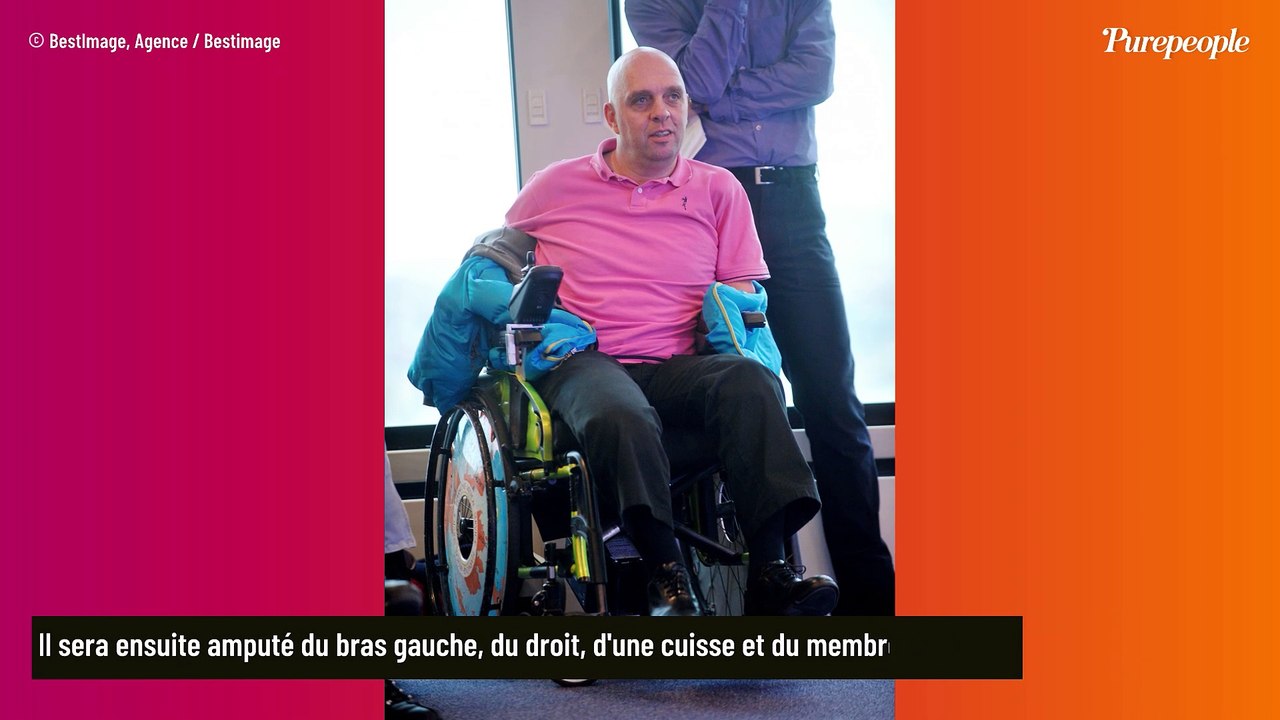 Philippe Croizon (The Wheel) : Ce terrible accident à 25 ans à l'origine de l'amputation de ses bras et de ses jambes
