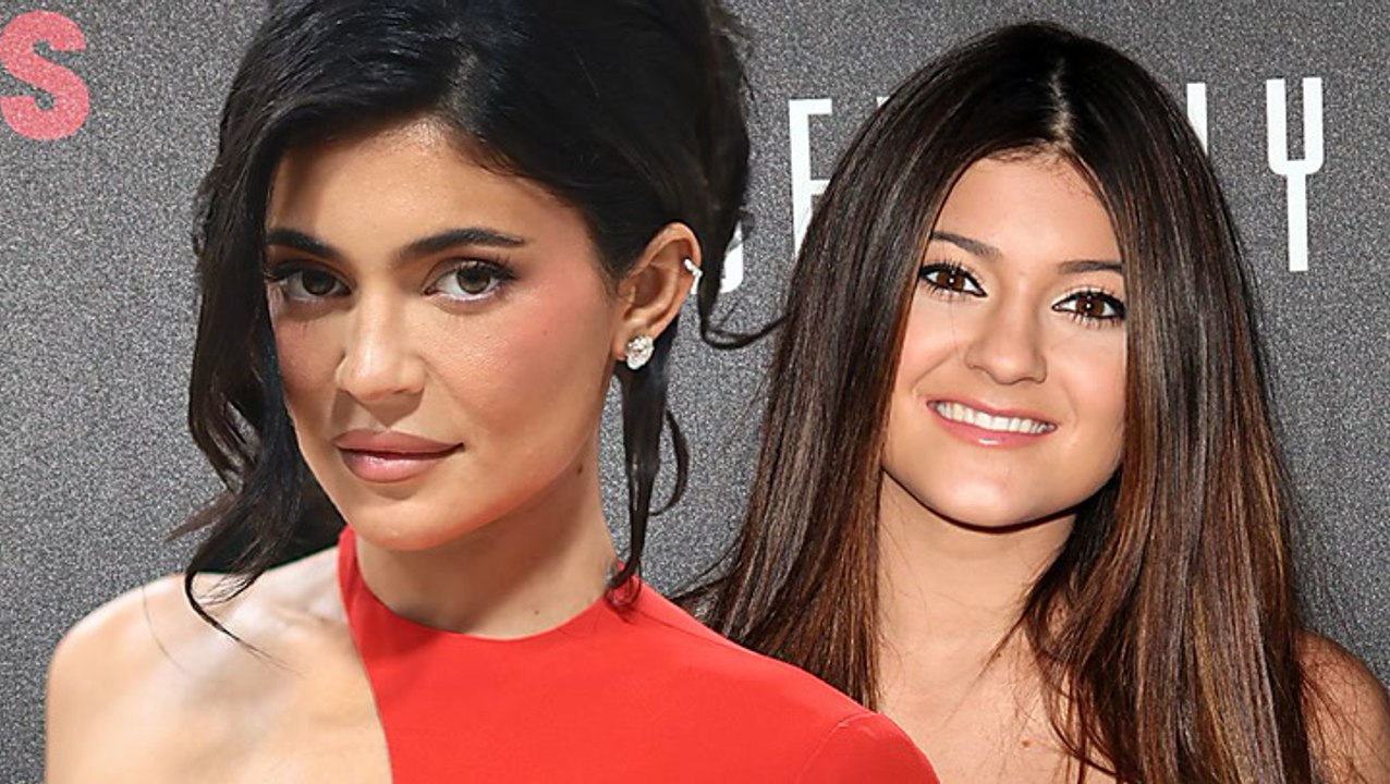So anders sah Kylie Jenner vor den ganzen Beauty-OPs aus