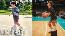 My Left Leg Is 9 Inches Shorter Than My Right | BORN DIFFERENT