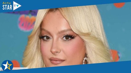 « Je vais mieux » : Bebe Rexha dévoile un cliché impressionnant de son oeil au beurre noir après l'a