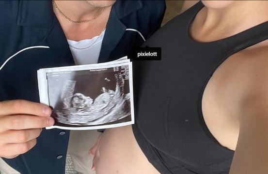 Pixie Lott is beyond excited to be expecting her first child with husband Oliver Cheshire