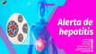 Buena Vibra | ¿Qué es la hepatitis? Causas, síntomas y tratamiento