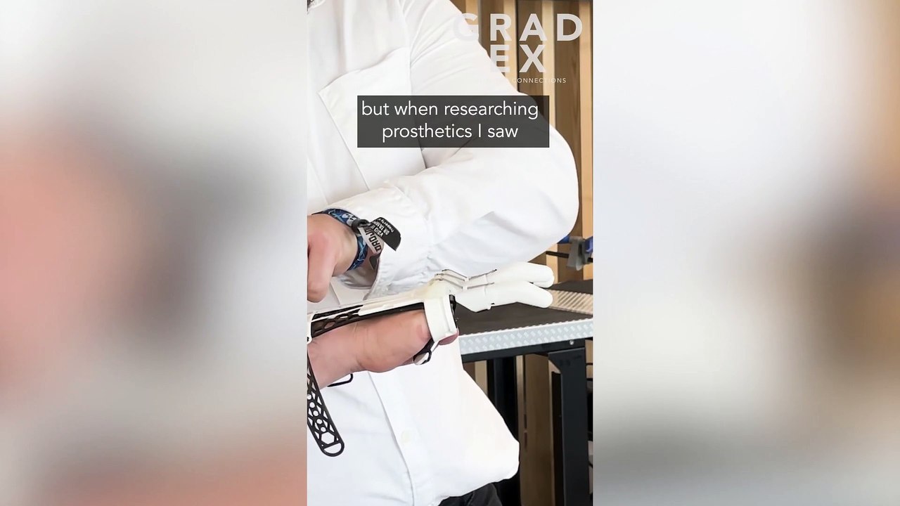 Student born with no fingers invents prosthetic hand for less than £20 - using 3D printer