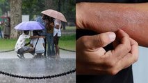 Skin Infections in Monsoon, Tips to avoid  | बारिश में स्किन इन्फेक्शन से ऐसे रहें दूर | Boldsky