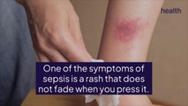 Sepsis Can Cause a Red Line on Your Skin—Here's What You Need To Know