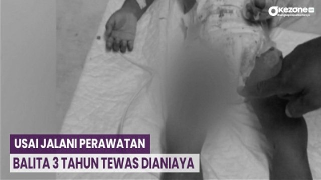 OKEFLASH: Usai Jalani Perawatan, Balita 3 Tahun Tewas Dianiaya