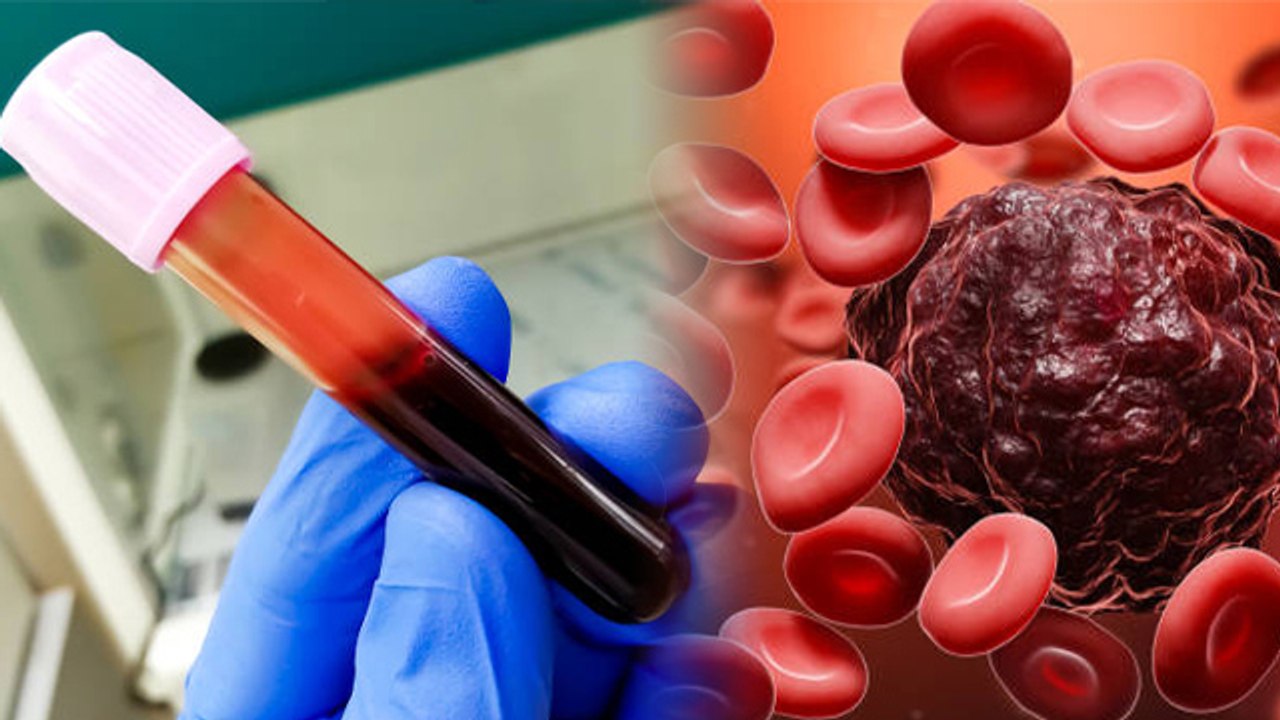 ESR Blood Test kya hai इ.एस.आर ब्लड टेस्ट क्या है ESR Blood Test