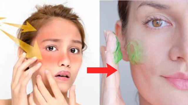 धूप से आने के बाद चेहरे पर क्या लगाना चाहिए | Dhoop Se Aane Ke Bad Chehre Par Kya Lagana Chahiye