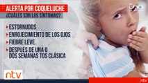 Alerta en Bolivia por los casos de Coqueluche