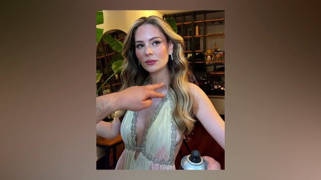 Güneş alerjisinden dolayı vücudu kabaran Yıldız Çağrı Atiksoy, son haliyle sevenlerini korkuttu