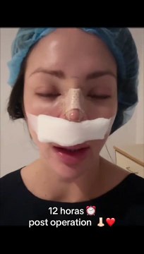 Sheyla Rojas se sometió a cirugía de nariz