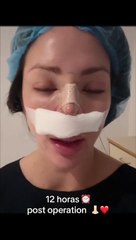 Sheyla Rojas se sometió a cirugía de nariz