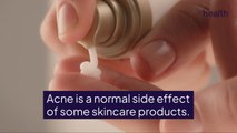 Is Your Skincare Product Causing Skin Purging?