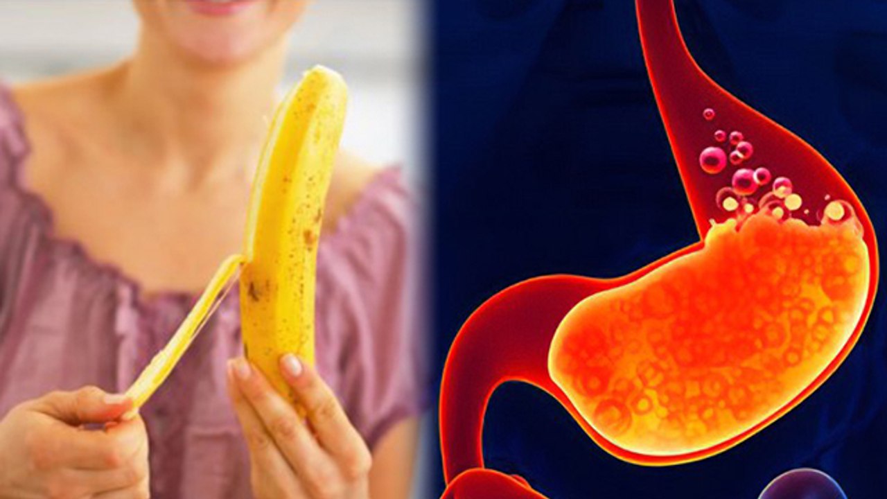 बरसात में केला खाना चाहिए कि नहीं | Barsat Me Kela Khana Chahiye Ki Nahi | Boldsky