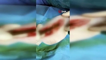 Oyun oynarken camdan atlayan kedinin karnına odun parçası saplandı