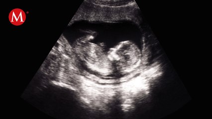 Mariana Nassar, diputada priista presenta el punto 'Código Mariposa'