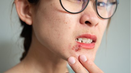 Google Lens: Here's how to check if you have any skin conditions on this app