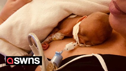 Mum of the UK’s most premature twins says they are going “strength to strength”