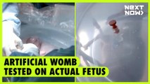 Artificial womb tested on actual fetus | NEXT NOW