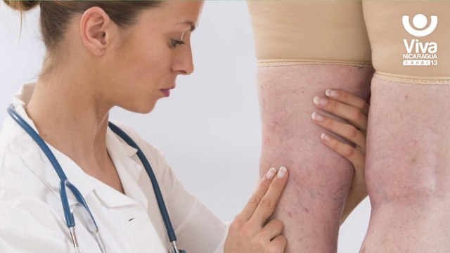 Síntomas, diagnóstico y tratamiento de la trombosis