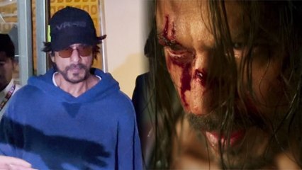 Shahrukh Khan का US Nose Surgery के बाद Mumbai Airport Video Viral, Injury गायब कैसे | Boldsky