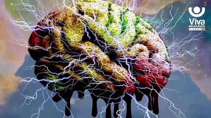 Enfermedad diferente que afecta el sistema neuronal del ser humano