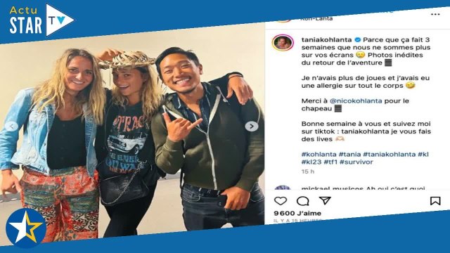 Koh-Lanta, le Feu sacré : pustules, cloques… des clichés choquants du corps de Tania dévoilés