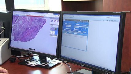 Descargar video: Avances en oncología y nuevos tratamientos están cambiando el pronóstico del cáncer de ovario