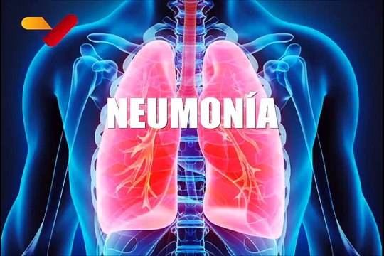 La Neumonía: una enfermedad que sigue afectando a millones en el mundo