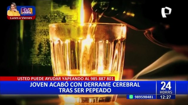 Los Olivos: hombre termina con derrame cerebral tras ser víctima de 'peperas'