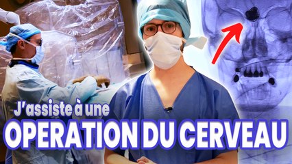 ANEVRISMES INTRACRANIENS : une bombe à retardement ?! - feat. @NantesUniversité @CNRS @Inserm