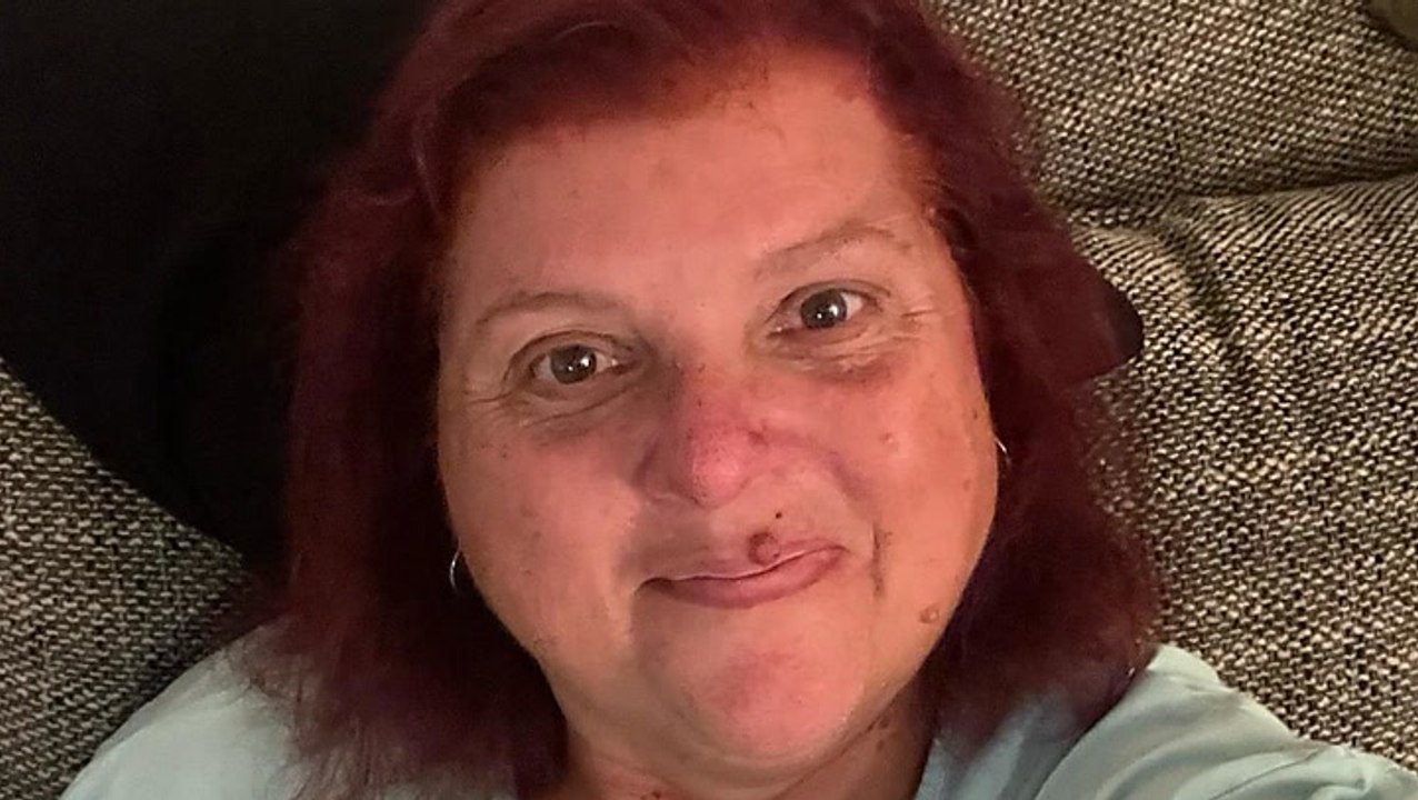 „Hartz und Herzlich“-Star bestätigt OP: DARUM sieht Carmen so anders aus