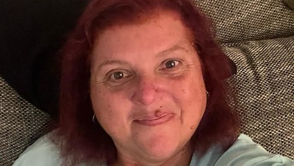 „Hartz und Herzlich“-Star bestätigt OP: DARUM sieht Carmen so anders aus