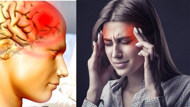 शाम को सिरदर्द क्यों होता है | Sham Ko Sir dard Kyon Hota Hai | Sham ko Sir Dard Hona | Boldsky