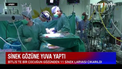 Gözde larva nasıl anlaşılır? Bu belirtilere dikkat!